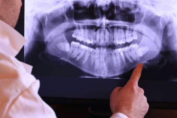 Best Emergency Root Canal Therapy in Park City, TN