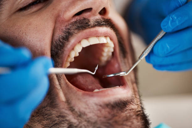 Best Emergency Care for Gum Disease in Park City, TN